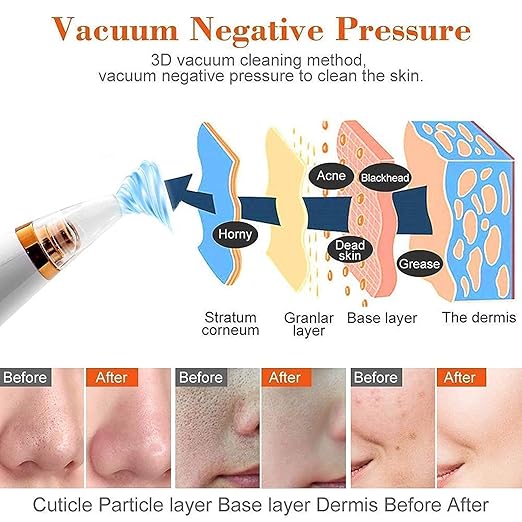Electric Derma Suction Machine